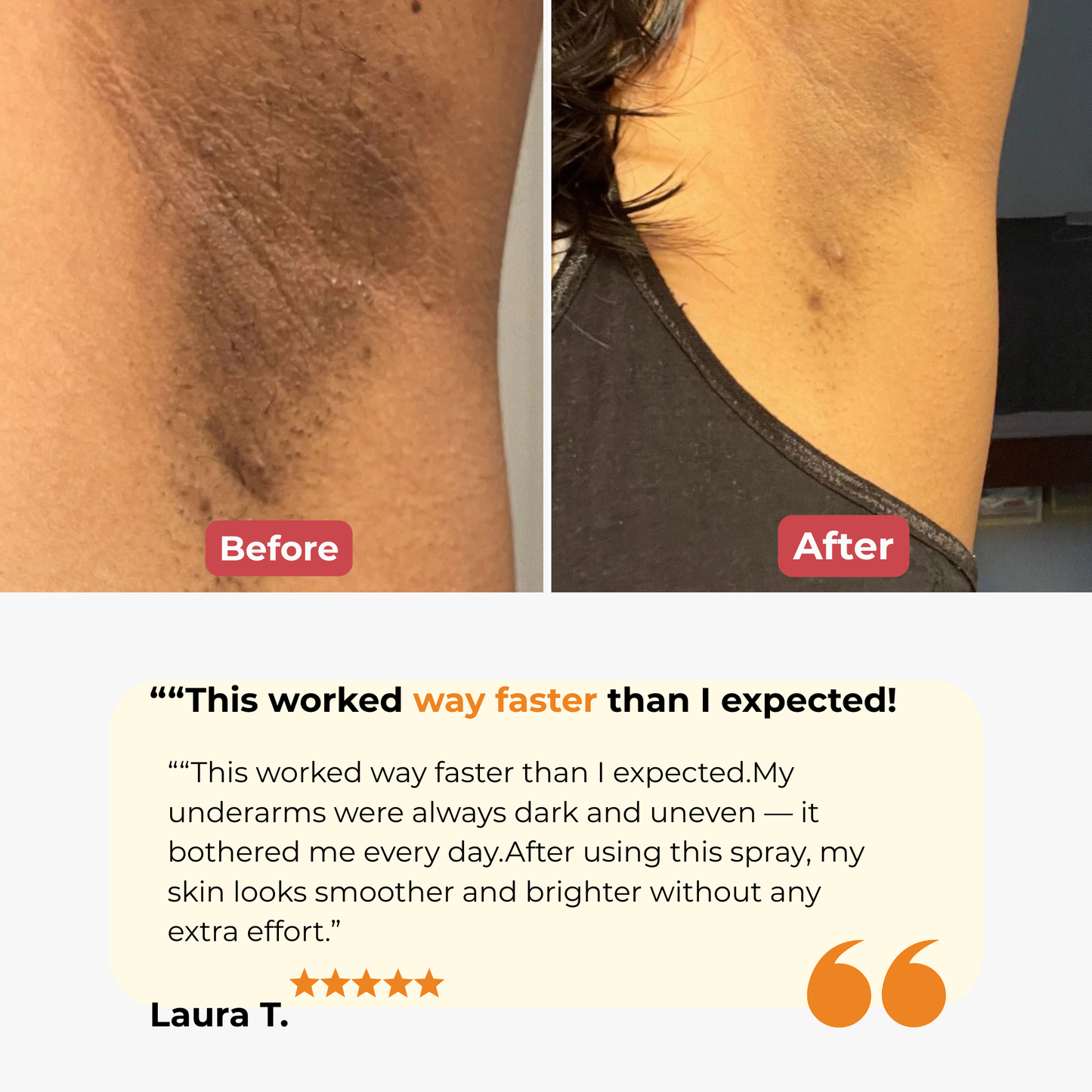 OceAura Peel Shot®