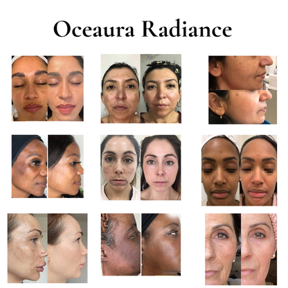 Oceaura Peel Shot