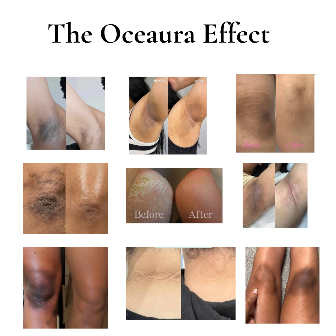 Oceaura Peel Shot